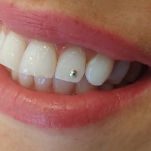 Dentální hygiena Nepomuk