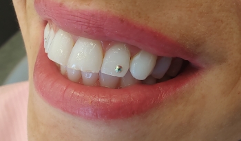 Dentální hygiena Nepomuk